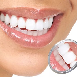 Улыбка пациентки в стоматологии